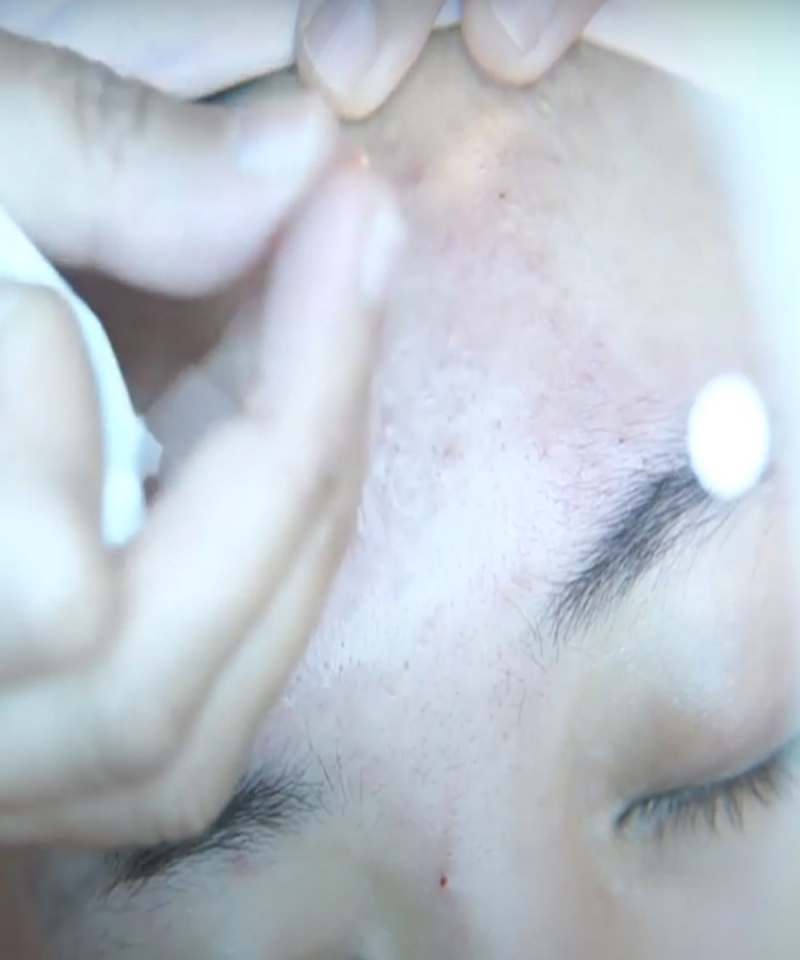 Ultimate Facial Glow Treatment - Aesthetic