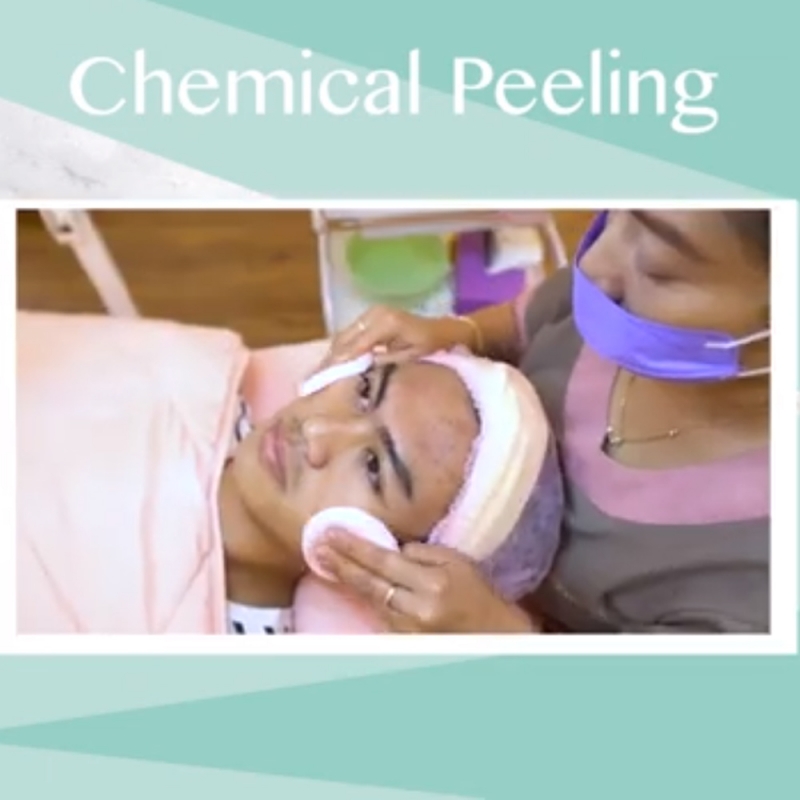 Gambaran Perawatan Chemical Peeling Pada Kulit Wajah