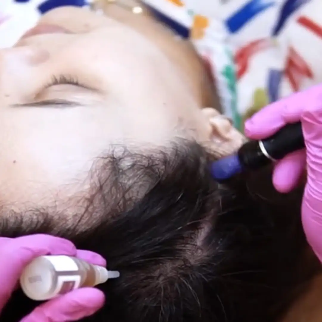 Hair Growth Treament - Memperbaiki Akar Rambut, Mengatasi Masalah Kerontokan