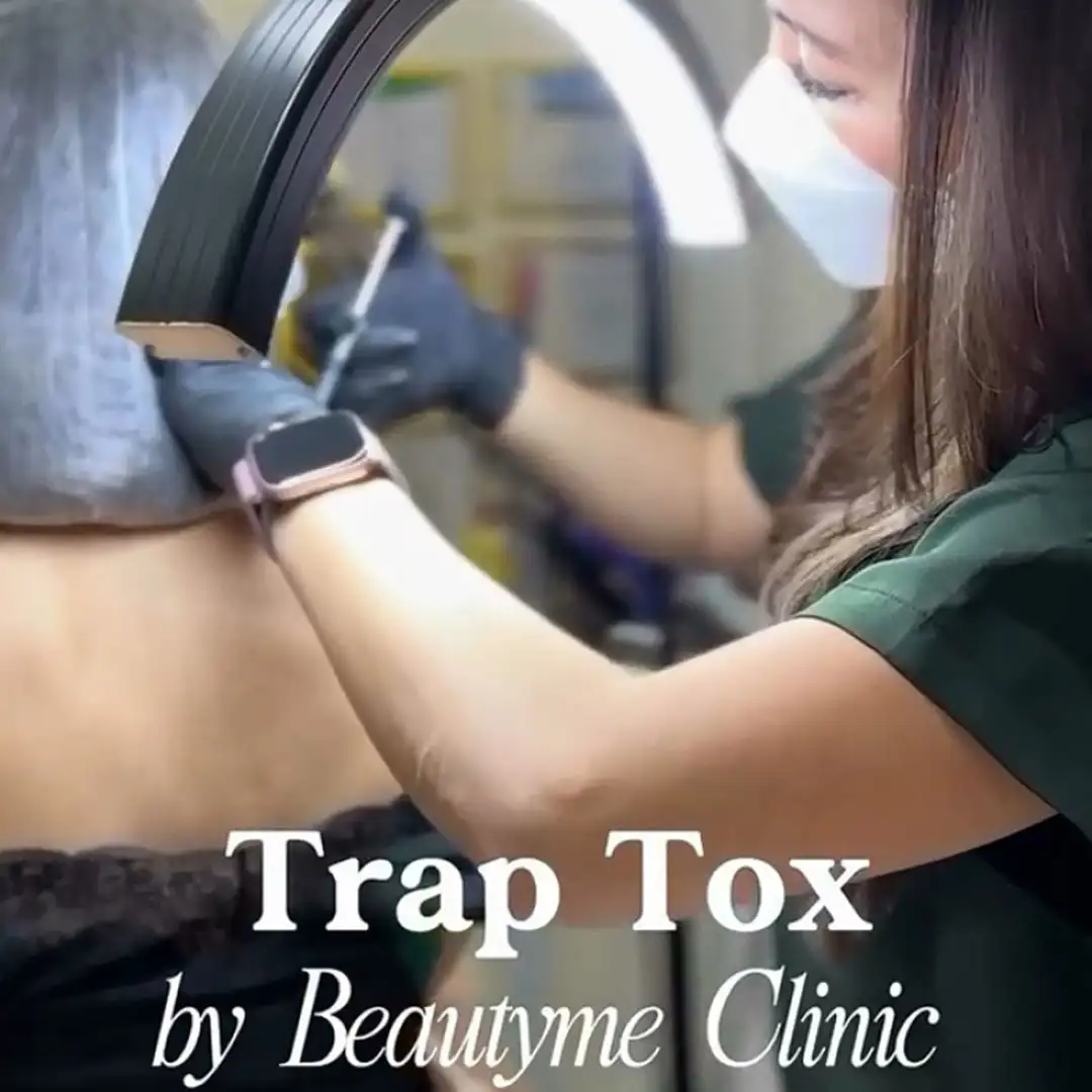 Saatnya Kenalan Dengan Treatment Trap Tox