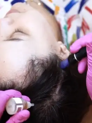 Hair Growth Treament - Memperbaiki Akar Rambut, Mengatasi Masalah Kerontokan