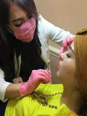 Biaya Suntik Filler Kantung Mata
