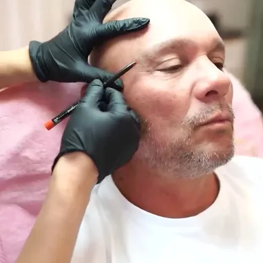 Atasi masalah Wrinkle di Mata Dahi dan Juga Pipi