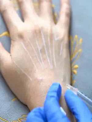Peremajaan Kulit Tangan / Hand Rejuvenation
