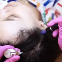 Hair Growth Treament - Memperbaiki Akar Rambut, Mengatasi Masalah Kerontokan
