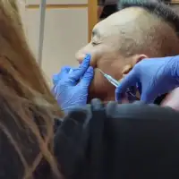 Skin Treatment For Volume Loss