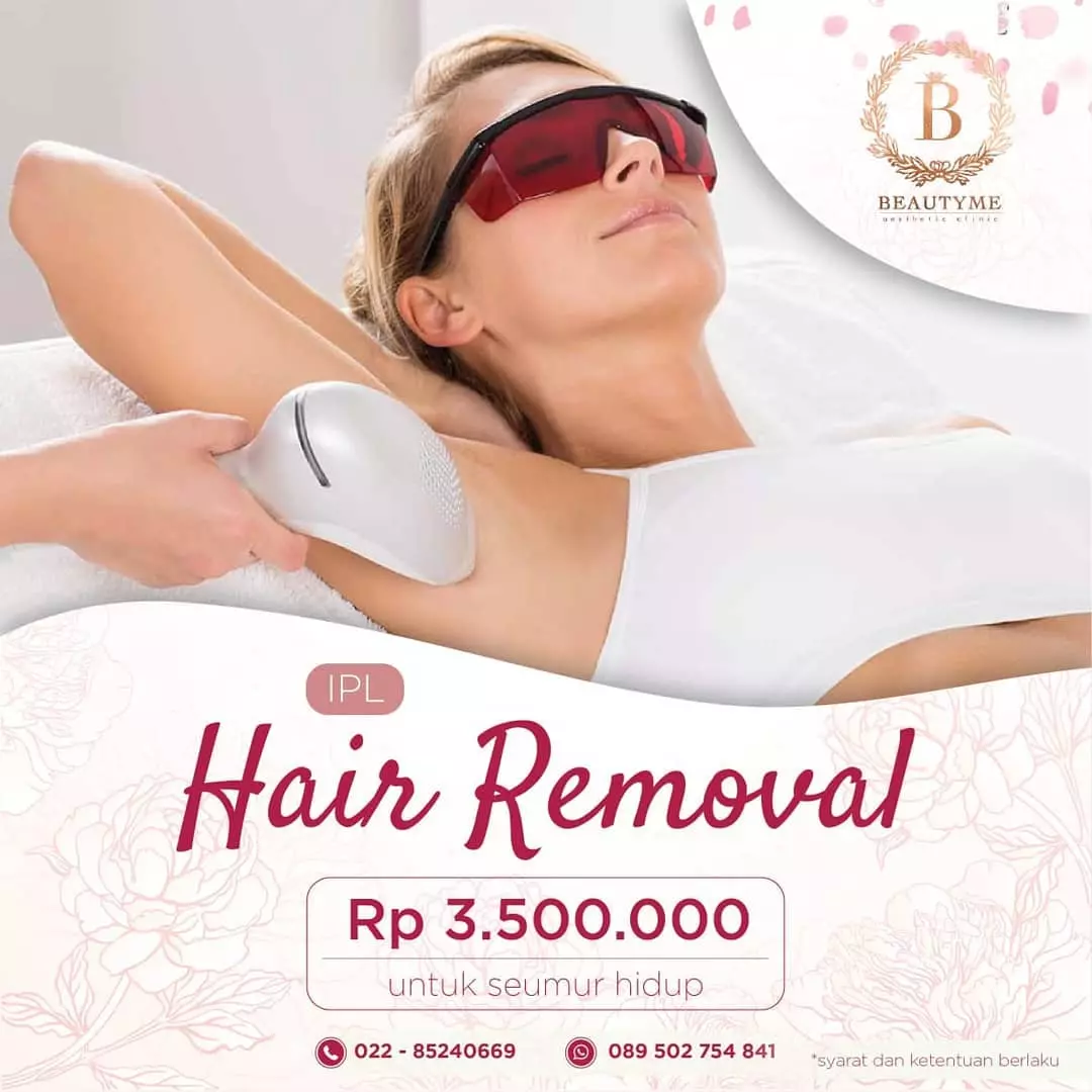 hair removal kecantikan hair removal kecantikan